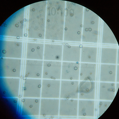 Yeast under a microscope